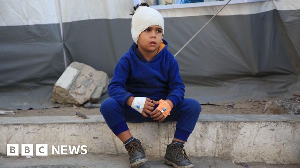 Reino Unido prepara evacuação de até 50 crianças gravemente feridas de Gaza para tratamento no NHS - Imagem do artigo